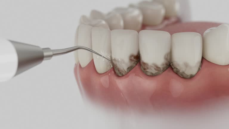 Reliable Dental Implants contractor in Linn County County, MO by Dentist Open Now